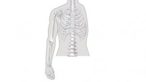 Schoudergordelamputatie - Amputatieniveaus arm-amputatie